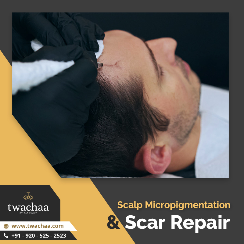 scalp micropigmentation scar repair