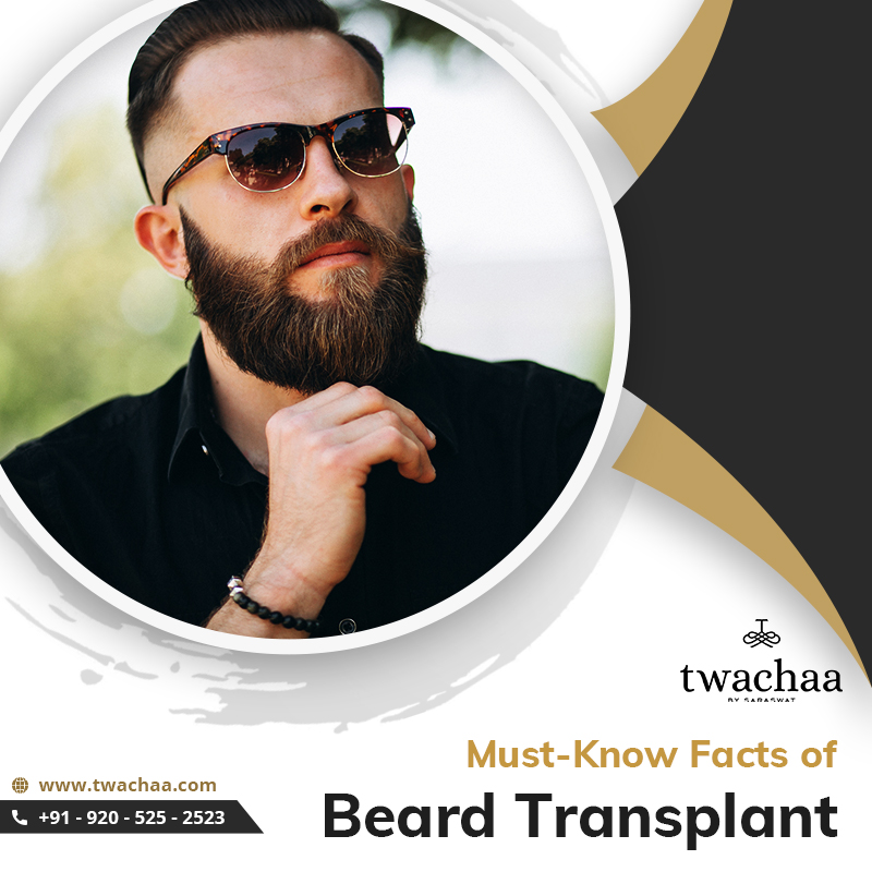 beard hair transplant
