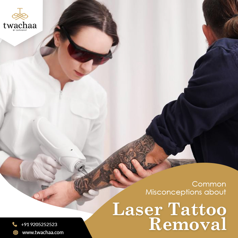 Common Misconceptions about Laser Tattoo Removal