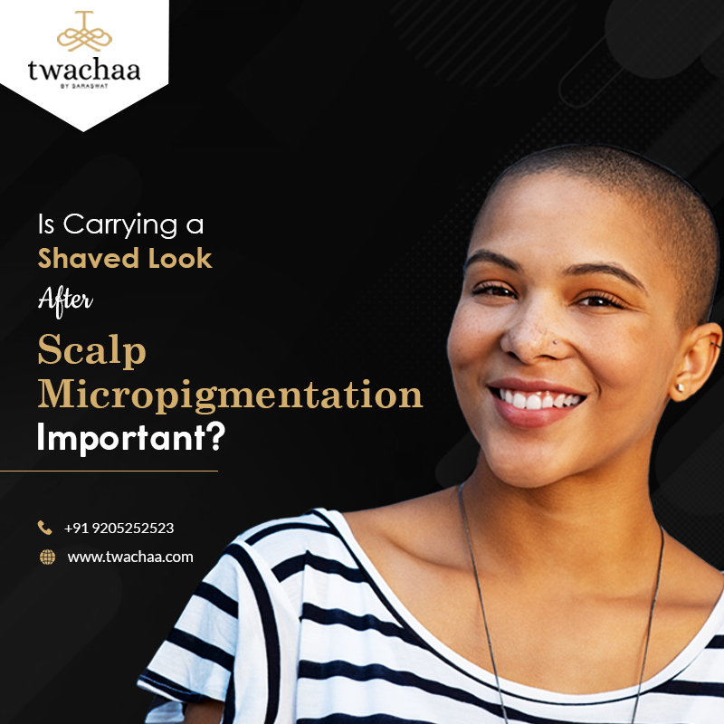 Is-Carrying-a-Shaved-Look-after-Scalp-Micropigmentation-Important
