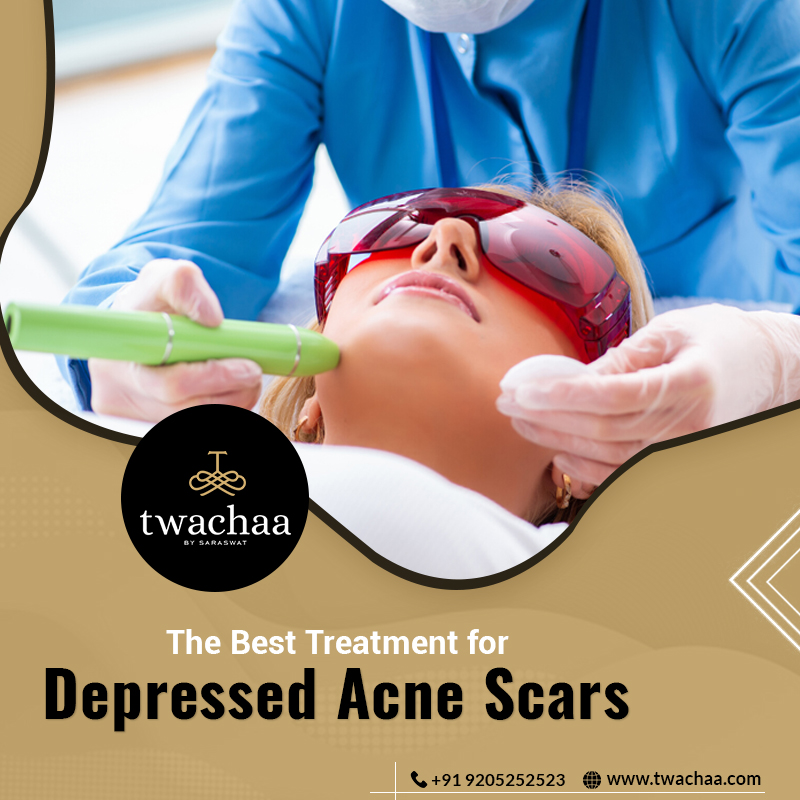 best treatment for depressed acne scars