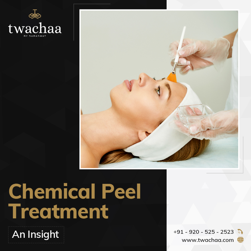 Insight to Chemical Peel Treatment in Gurgaon