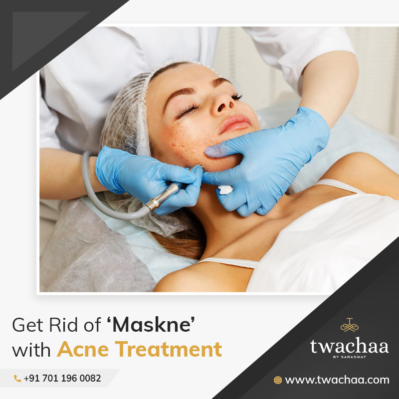 Get Rid of ‘Maskne’ with Acne Treatment