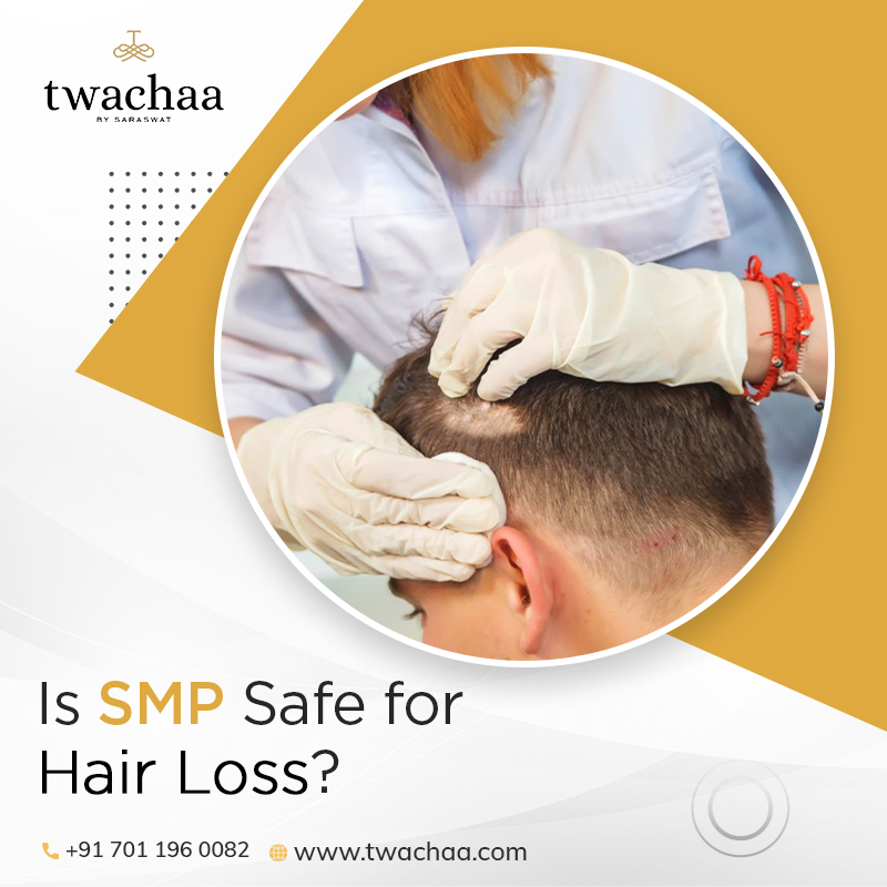 Scalp Micropigmentation a Safe Procedure for Hair Loss