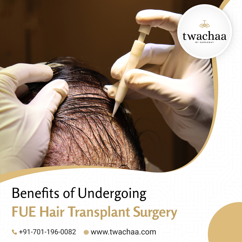 Advantages of Undergoing an FUE Hair Transplant in Gurgaon