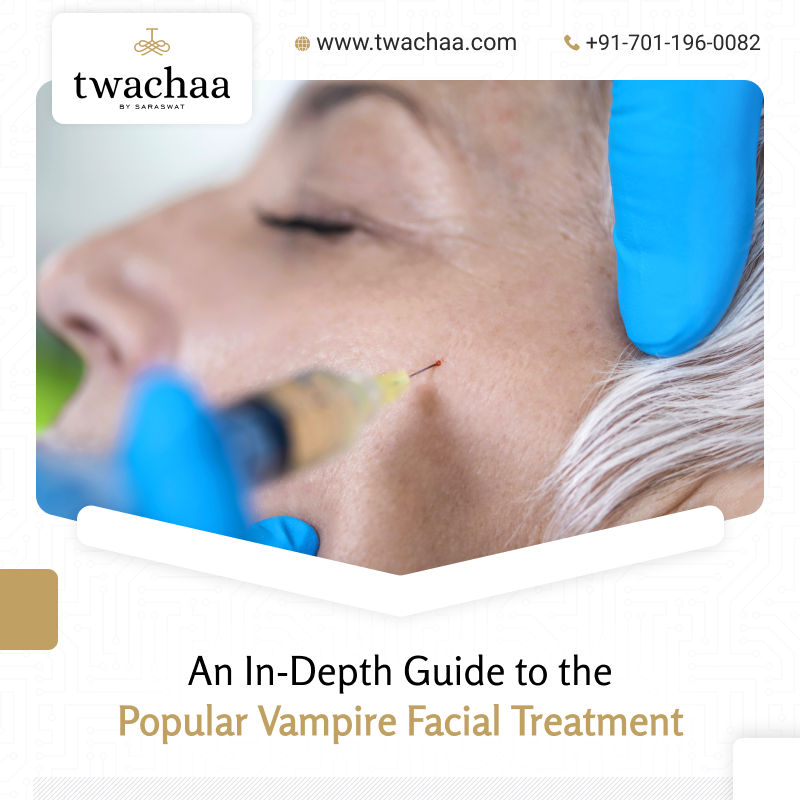 Vampire facial treatment in Gurgaon