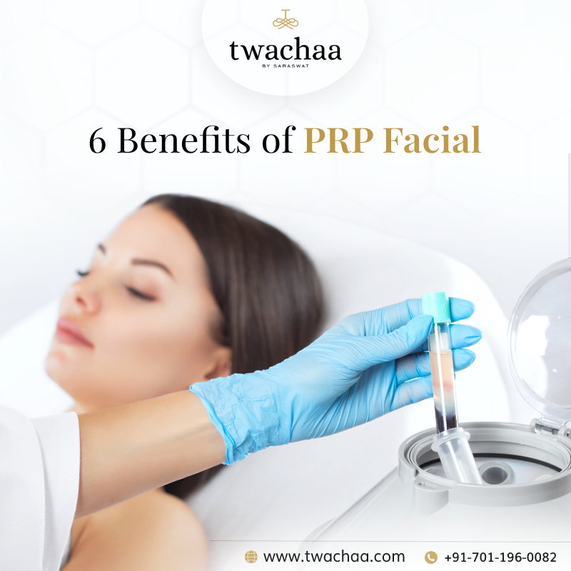 Benefits of PRP Facial