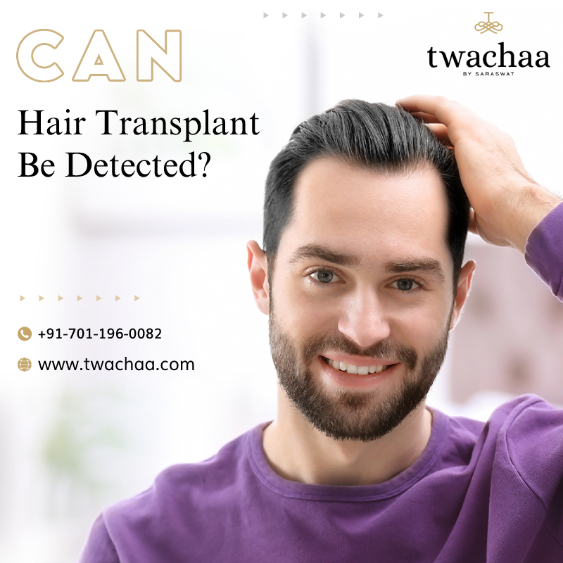 Can Hair Transplant Be Detected?