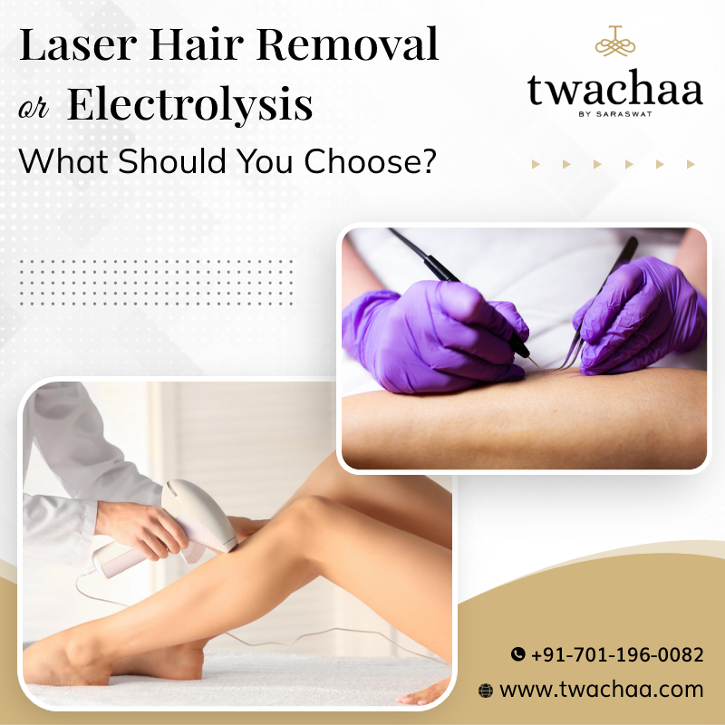 Laser Hair Removal or Electrolysis – What Should You Choose?