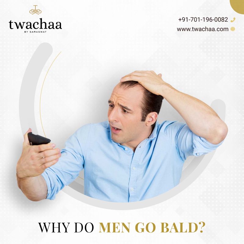 Why Do Males Go Bald? – The Best Hair Transplant in Faridabad