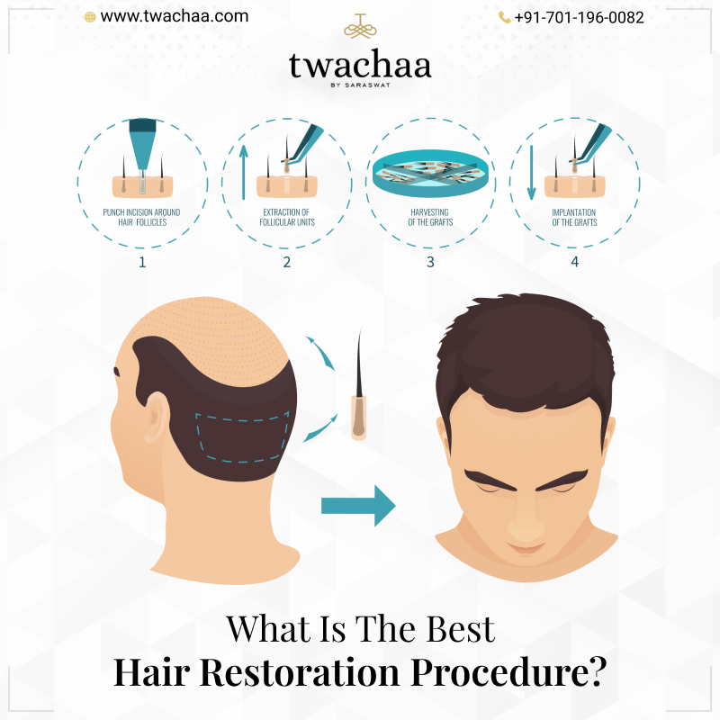 What Is The Best Hair Restoration Procedure?
