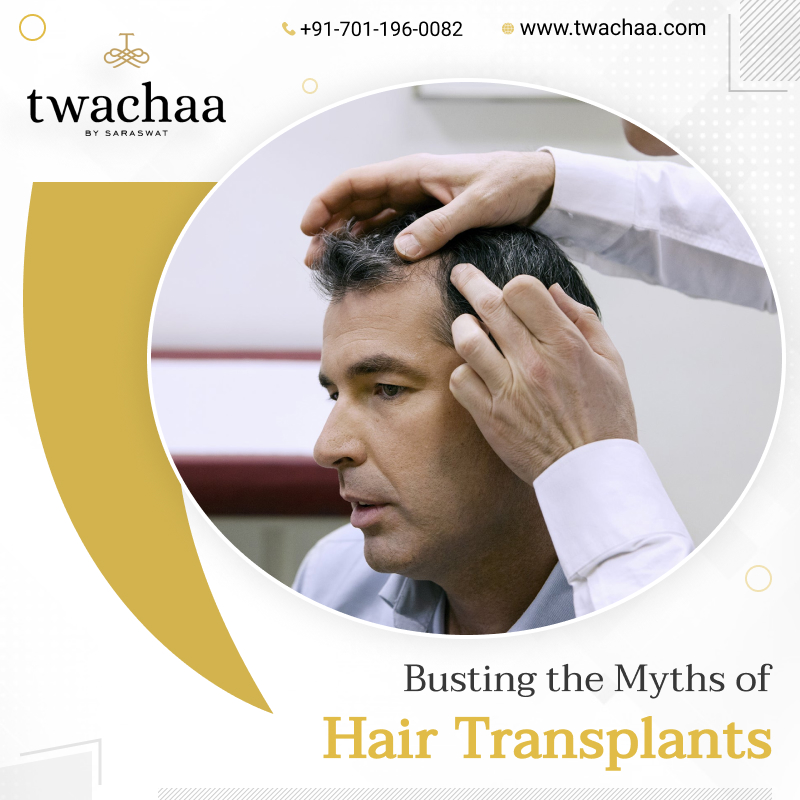 Busting the Myths of Hair Transplants
