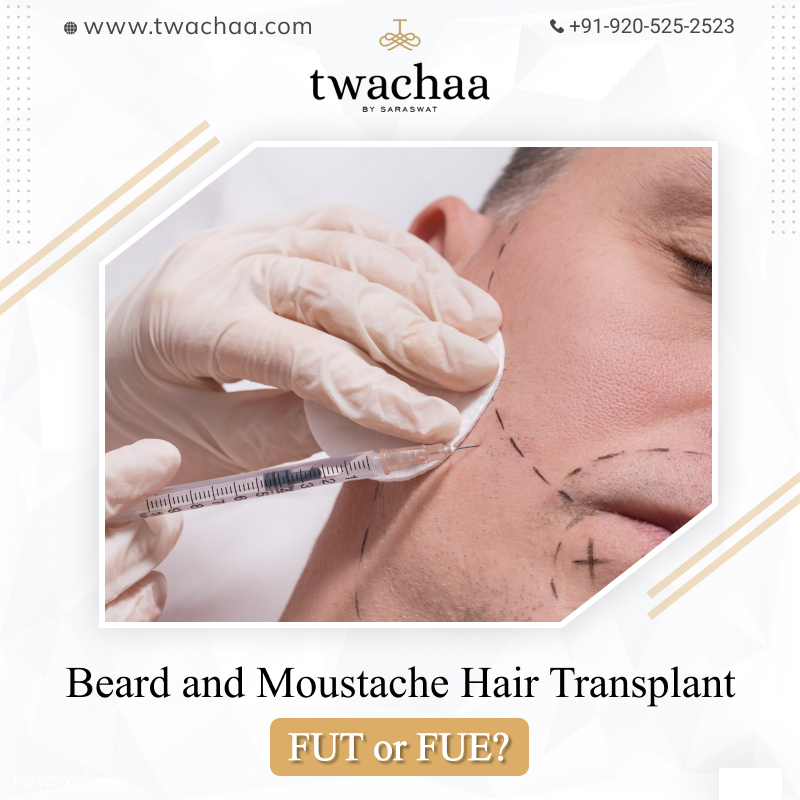 beard and moustache transplant in faridabad