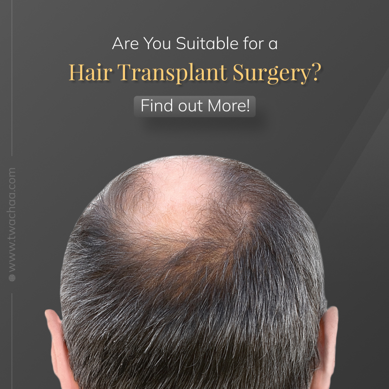 Are You a Good Candidate for Hair Transplant Surgery Know the Answer