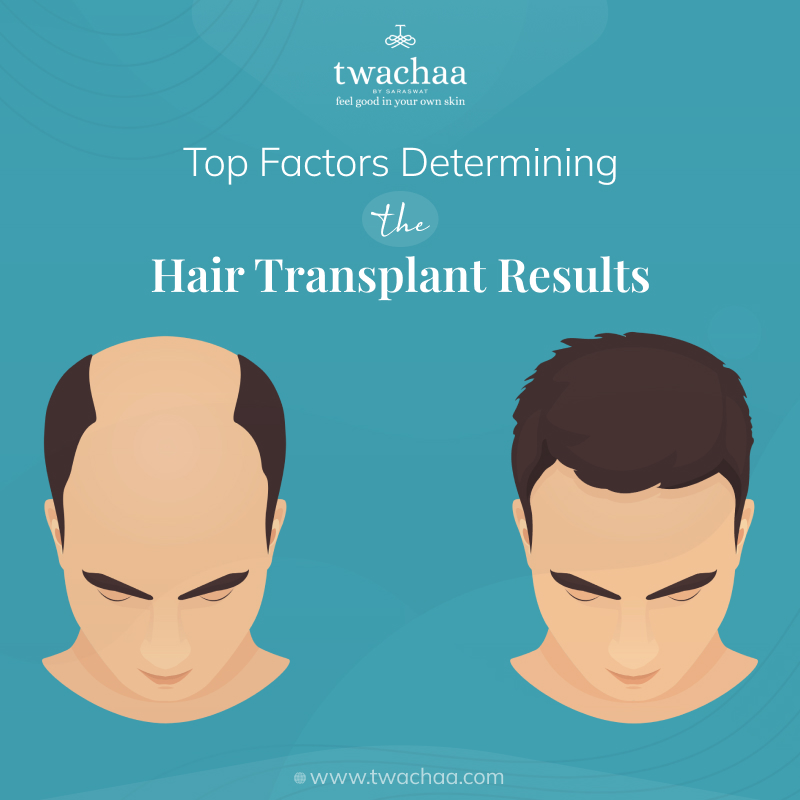 Factors for Successful Hair Transplants