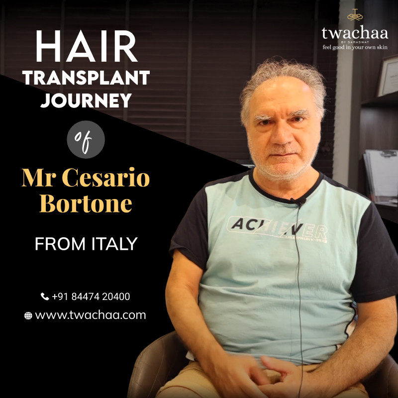 ceraio-hair-transplant