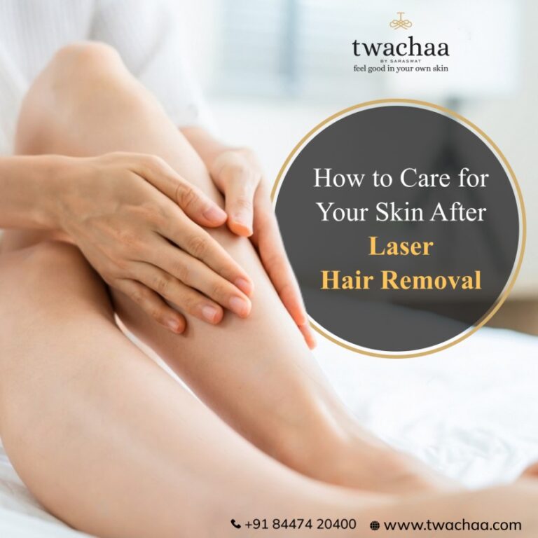 Top Tips To Care For Your Skin After Laser Hair Removal 