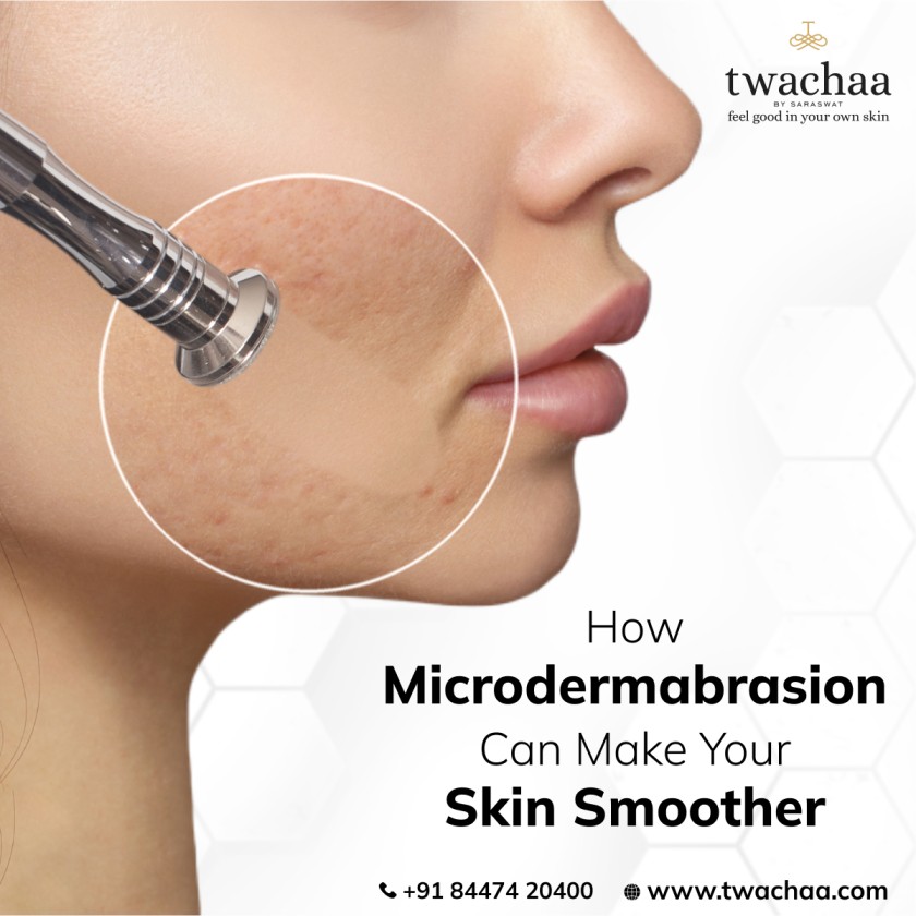 How Microdermabrasion Gives You a Smoother Appearance