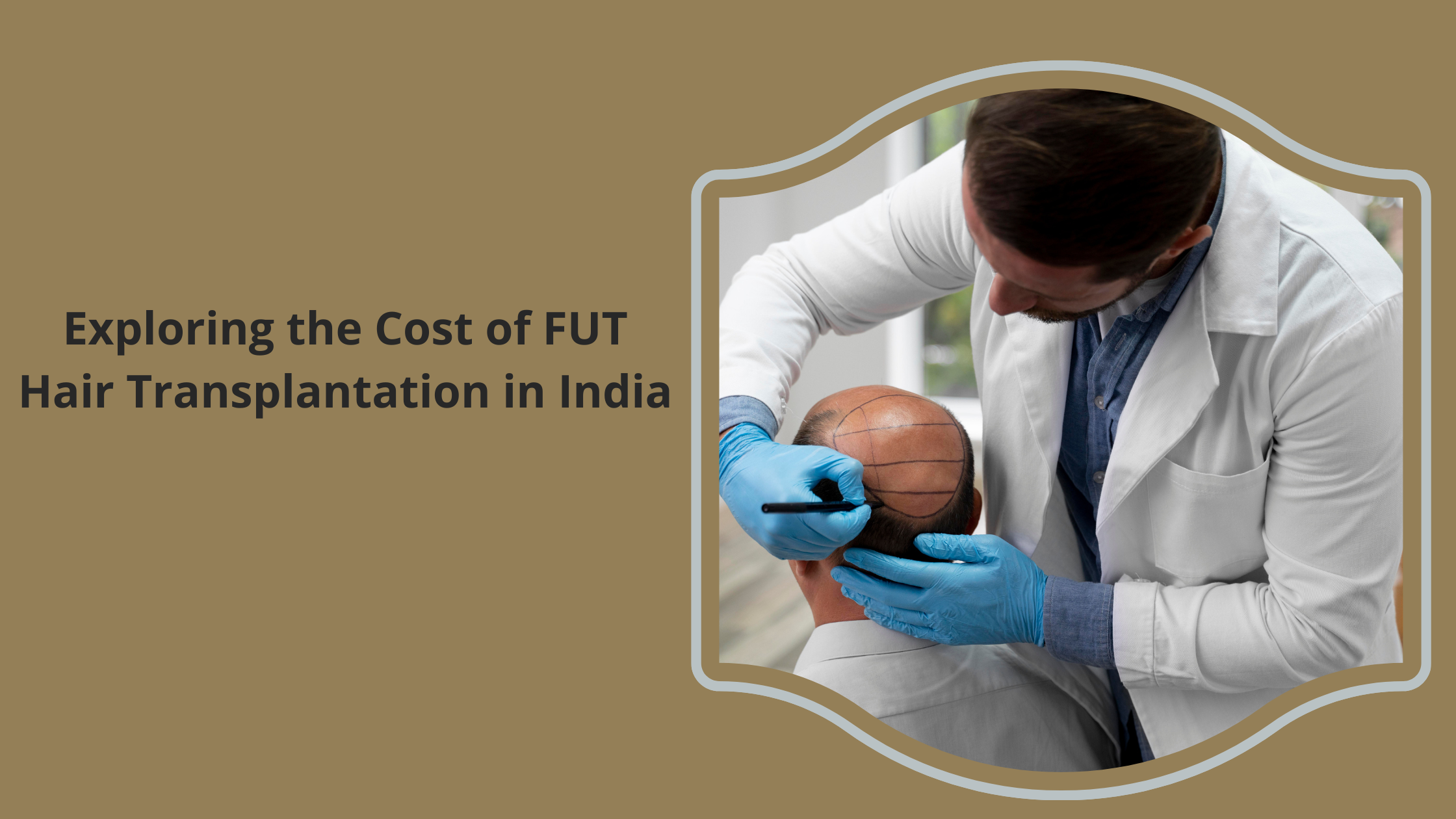 FUT hair transplantation in India