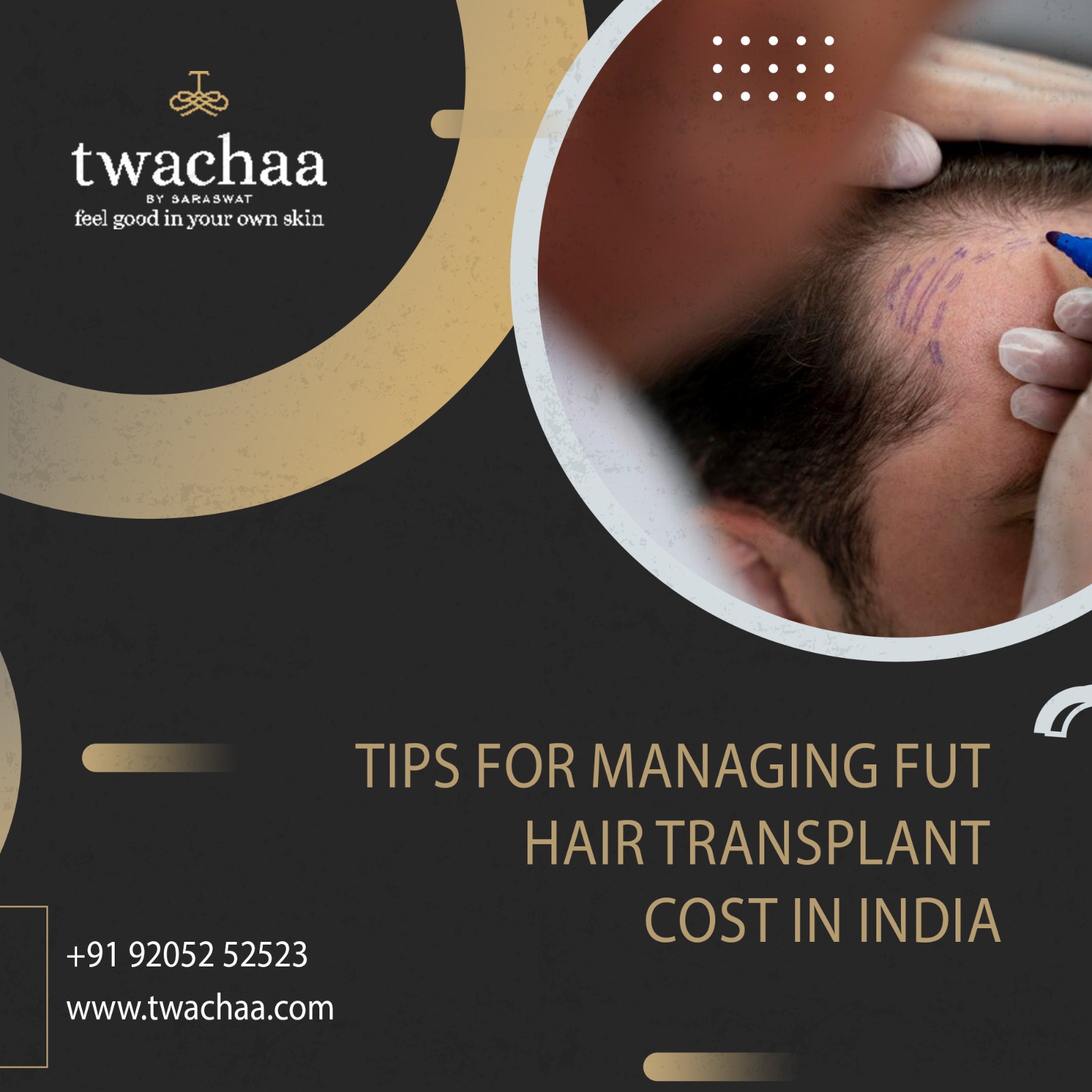 FUT Hair Transplant Cost in India