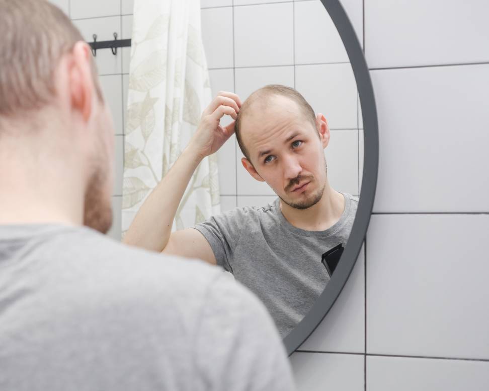 Best Hair Loss Treatment in Dubai for Men and Where to Find It? - AHS UAE